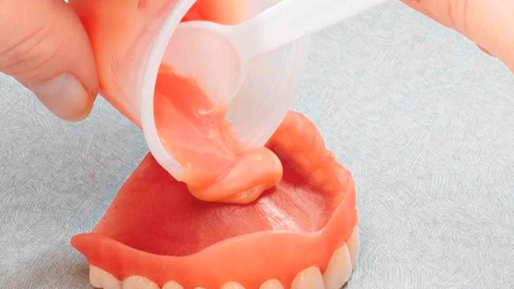 How Much Does it Cost To Reline Dentures
